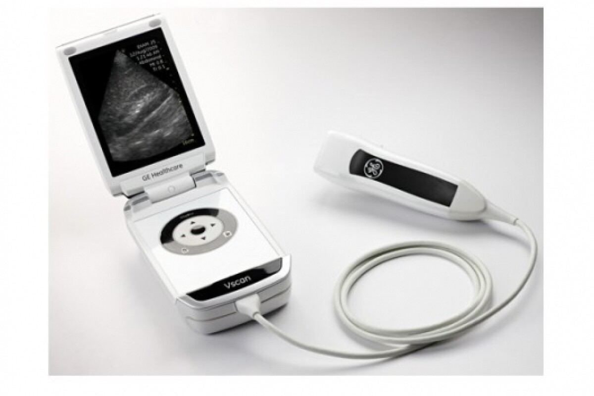 GE Vscan portable ultrasound scanner unveiled