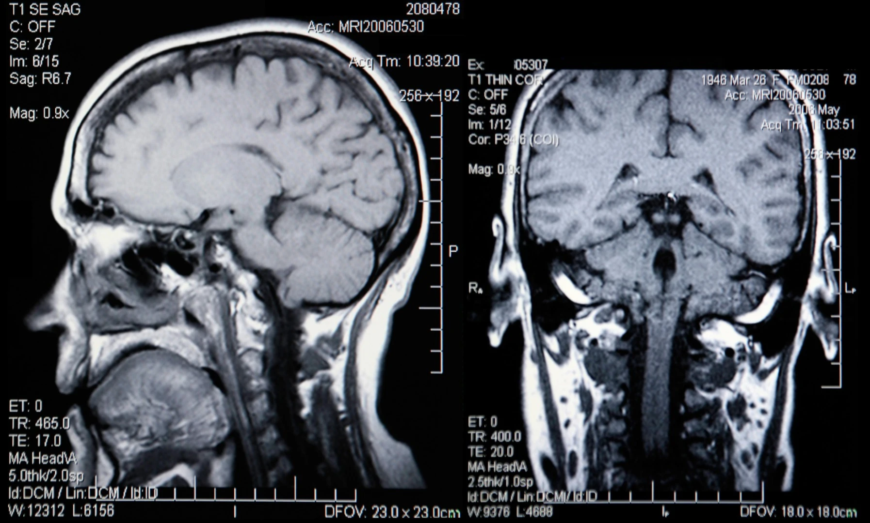 When it comes to determining our biological age, size matters