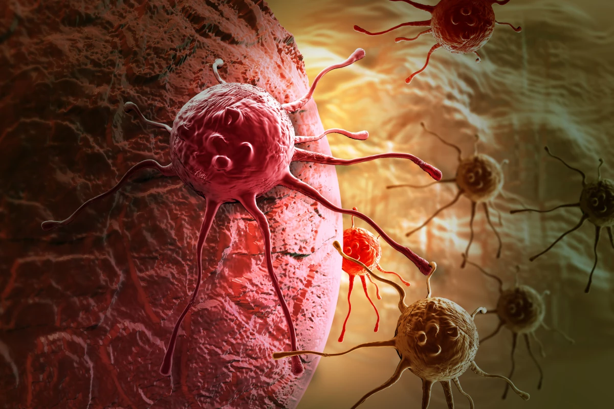 A vaccine induces the body into producing antibodies that help immune cells detect and kill cancer cells