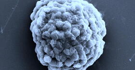 An image of a sugary droplet packed with hydrogen-producing algal cells