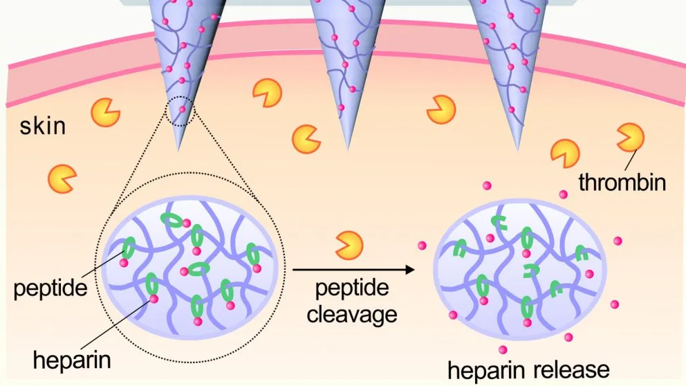 An illustration showing how the microneedles dissolve in the presence of thrombin to release their clot-busting payloads