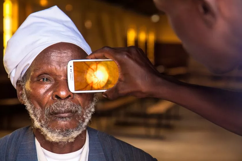 Peek is a smartphone-based eye-testing kit being developed in the UK (Photo: Peek)