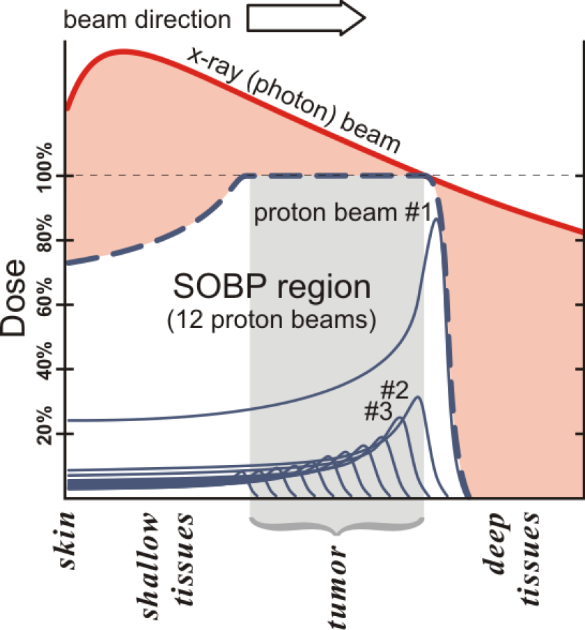 Proton therapy distributes the radiation dose in a series of beams of varied intensity that affect the cancerous region and little else, whereas a more traditional x-ray beam does significant damage to surrounding tissue (Image: MarkFilipak)