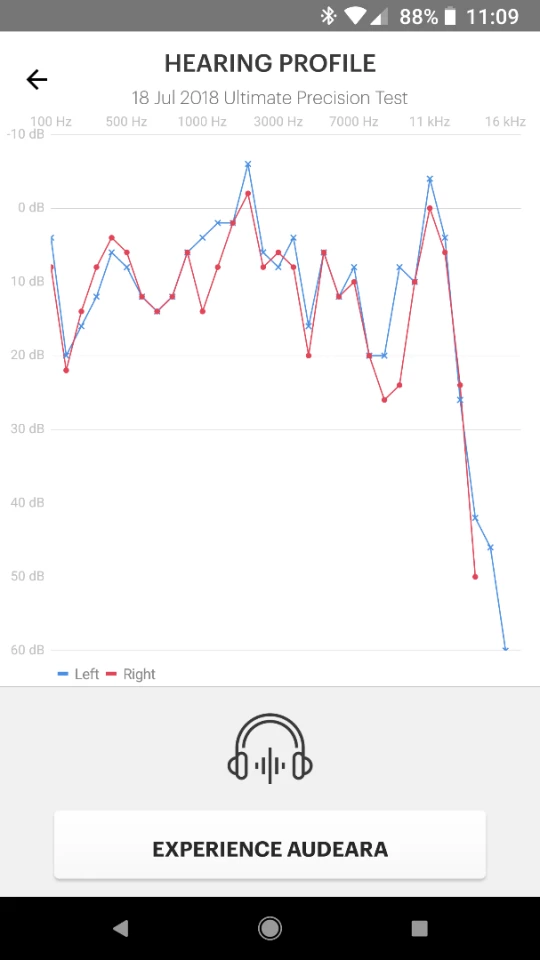 My hearing curve, as measured by the Audeara A-01 system's built-in hearing test