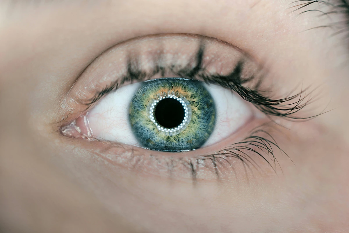 3D-printed cornea restores sight in a legally blind patient for the first time