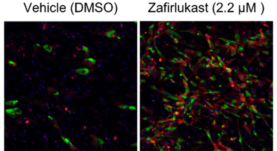 Administering of zafirlukast, an approved asthma drug, has been found to promote brown fat formation (seen in red on right)