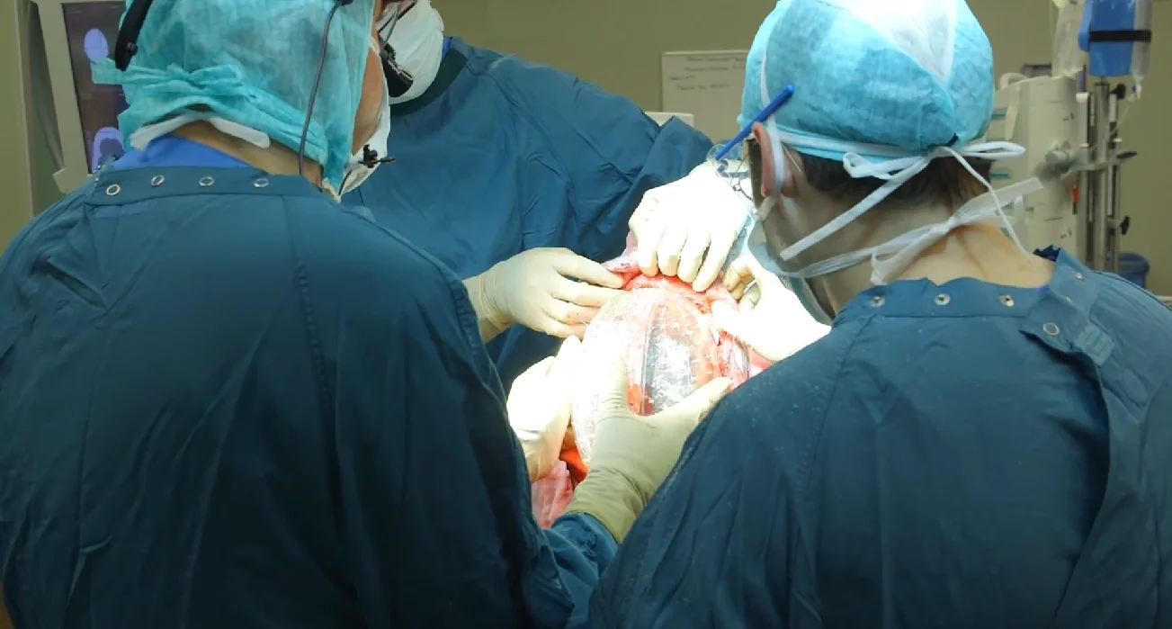 The 3D-printed replacement was designed to accurately fit the patient's head