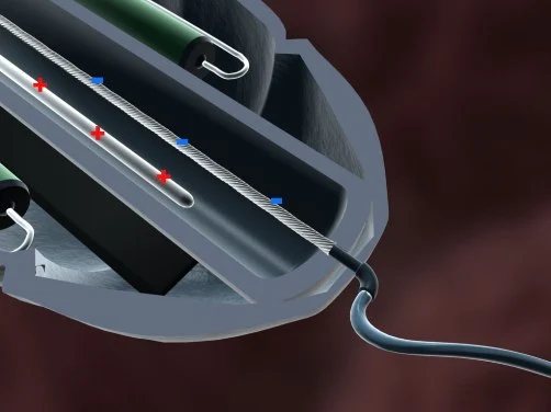 Scientists have created a tiny artificial muscle, that could be used in motors to propel nanobots inside the human body (Image: University of Wollongong)
