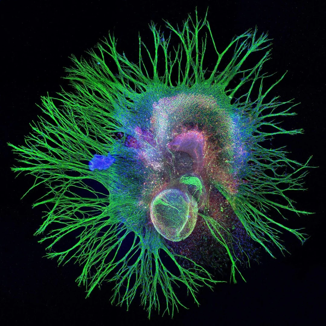 Image of Distinction: Inner ear neurons of a mouse