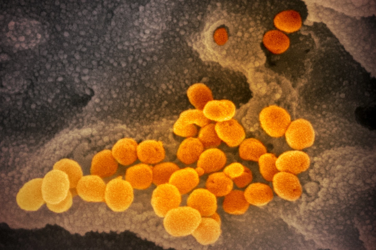 The novel coronavirus particles colored orange, emerging from cells colored gray