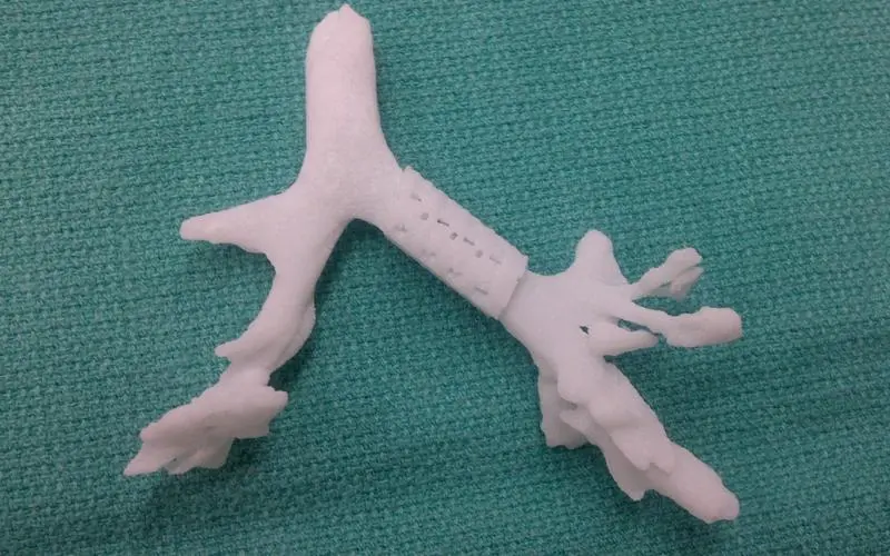 A cast of baby Kaiba's airway, with the splint around it on the right