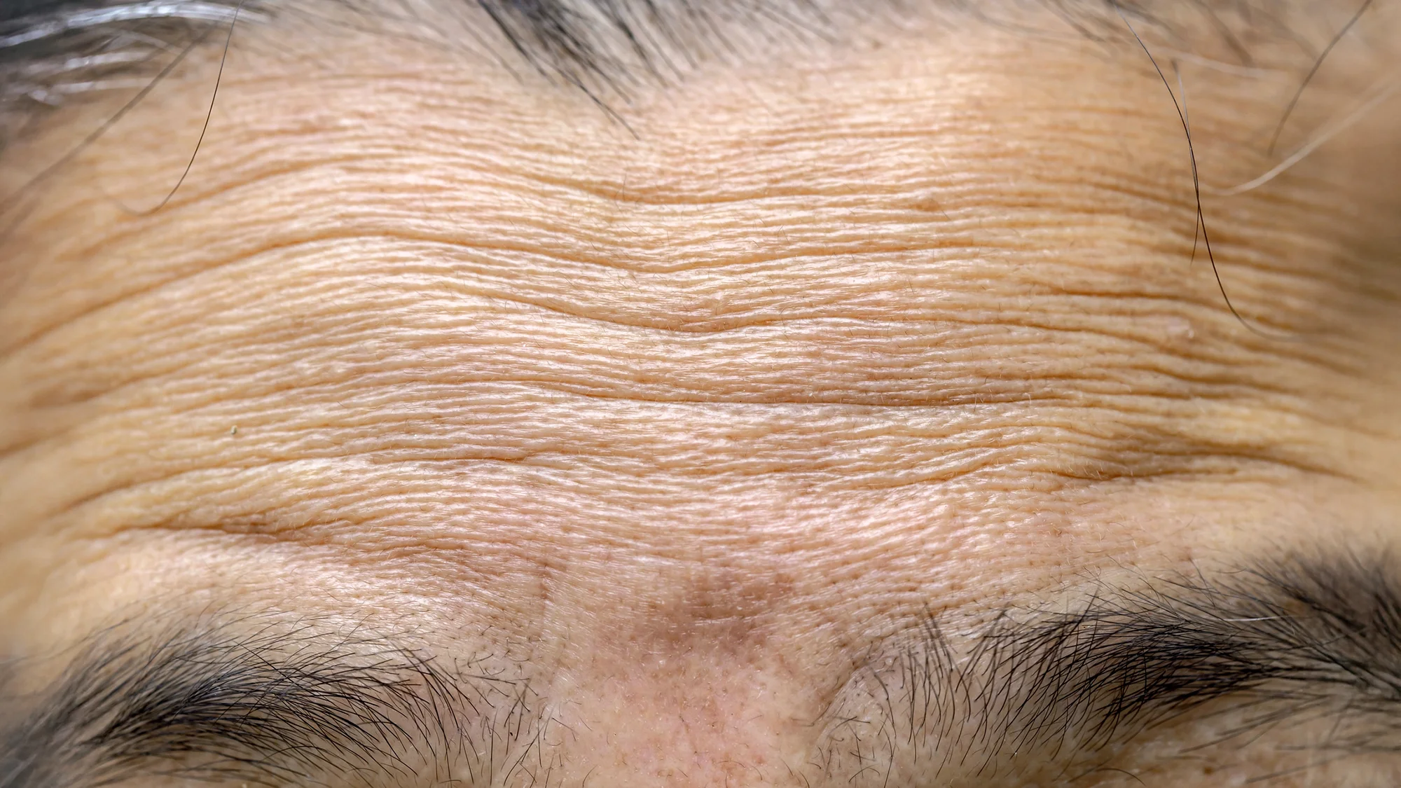 Wrinkle Def New study reveals why wrinkles deepen with age