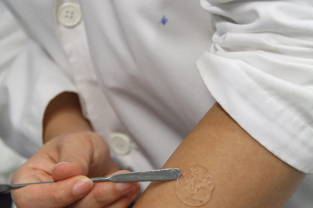 A nanogel developed at IBN may be commercialized as a membrane patch for faster healing of burn wounds (Photo:Institute of Bioengineering and Nanotechnology)