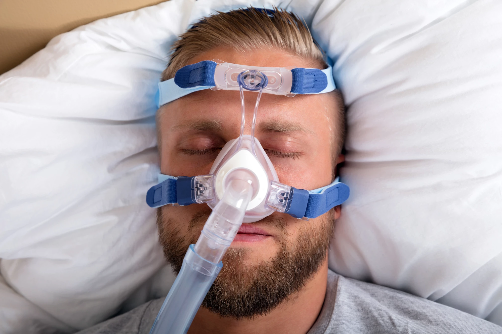 CPAP machines are the first-line treatment for sleep apnea, but they're poorly tolerated