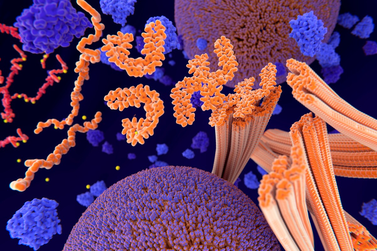 An artist's impression of tau tangles taking hold in the brain, which are considered one of the drivers of Alzheimer's disease