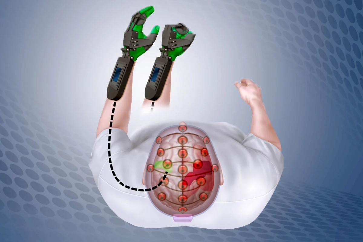 An illustration of how the device creates new motor pathways in the brain