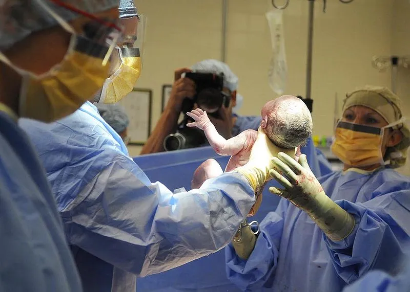 PREDIBIRTH is a software system that determines how likely pregnant women are to experience difficult labor, in order to reduce the need for emergency cesarean-sections