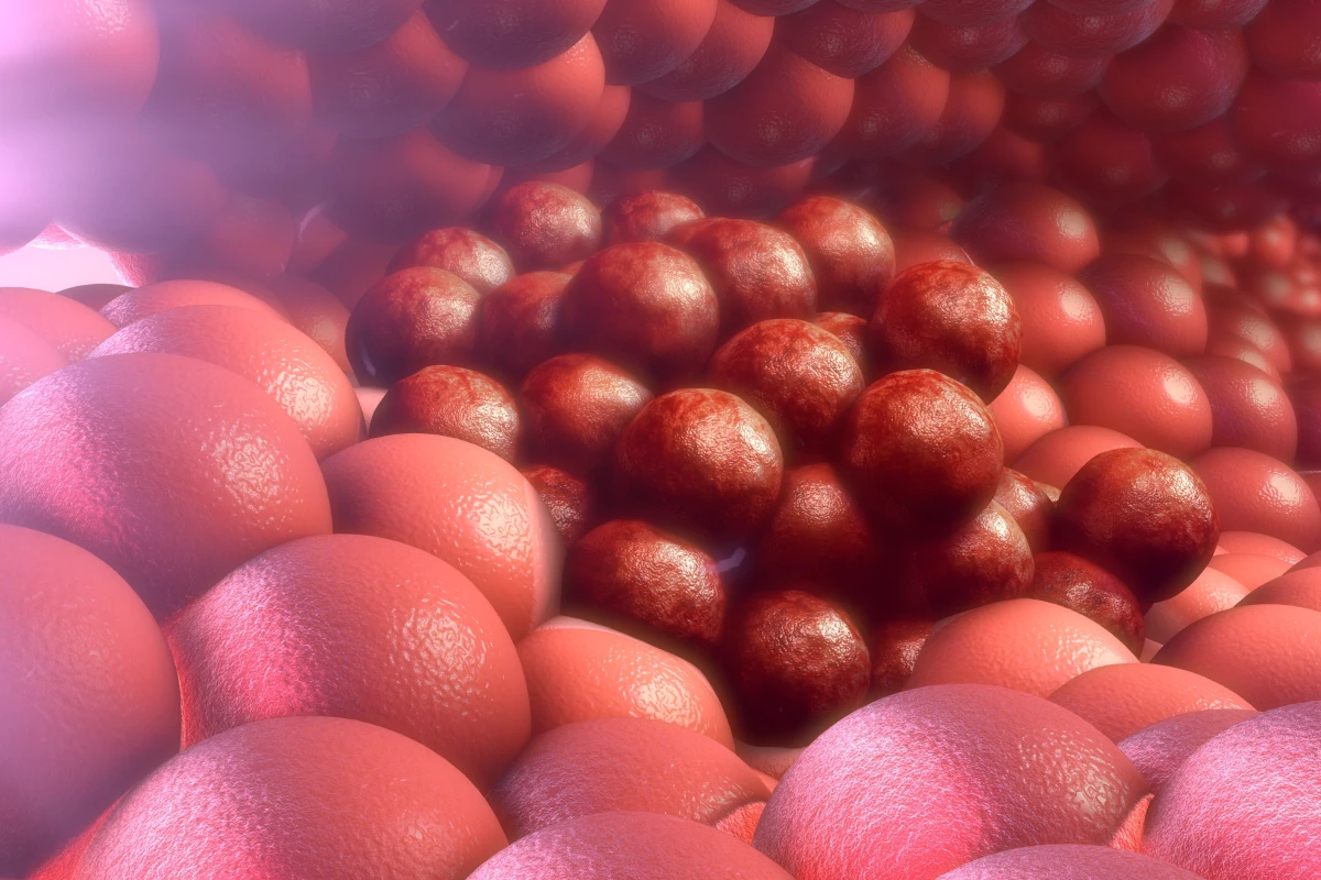 A newly developed hydrogel could target cancer cells by responding to changes in temperature and pH levels to release cancer-killing drugs