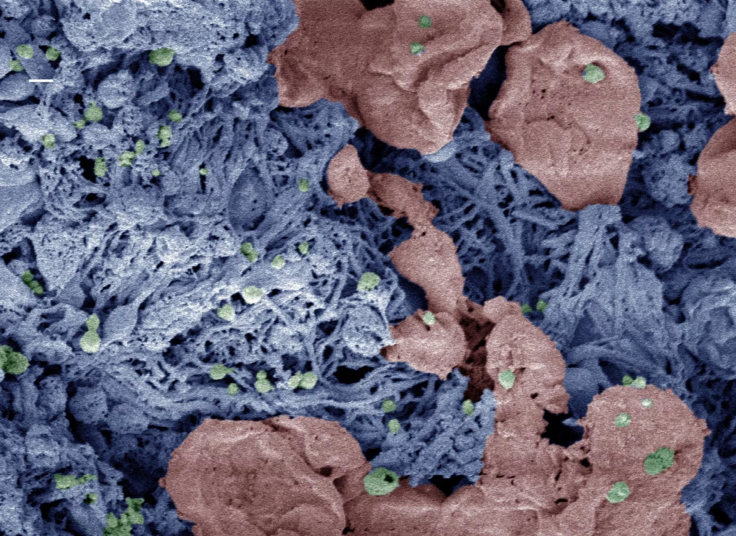 Nanoparticles (green) help form clots in an injured liver, in this color-enhanced microscope image