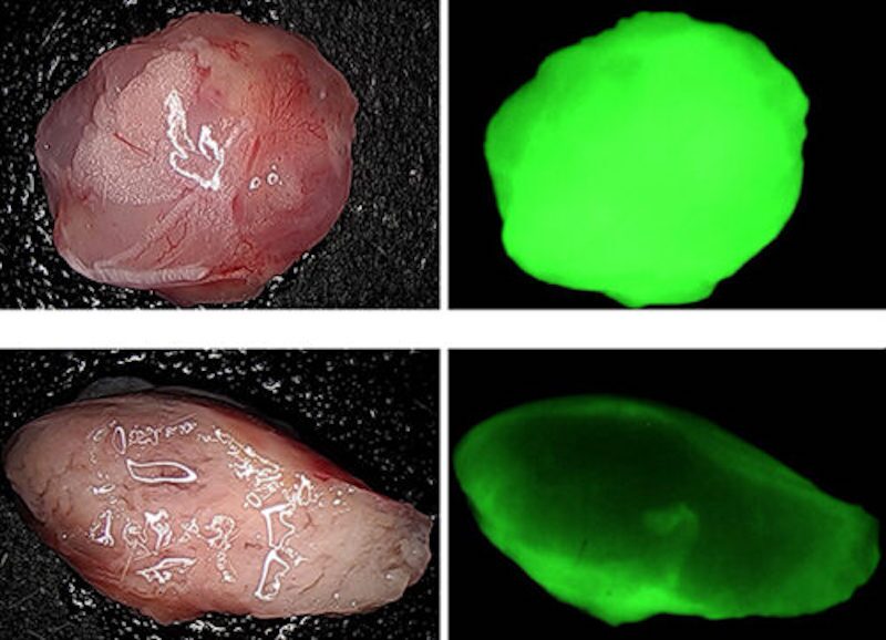 Un tumor no tratado (arriba a la izquierda) es muy ácido, como se ve con su perfil de fluorescencia (arriba a la derecha). Sin embargo, a los pocos días del nuevo tratamiento, el tumor (abajo a la derecha) comienza a encogerse y su acidez disminuye (abajo a la derecha)