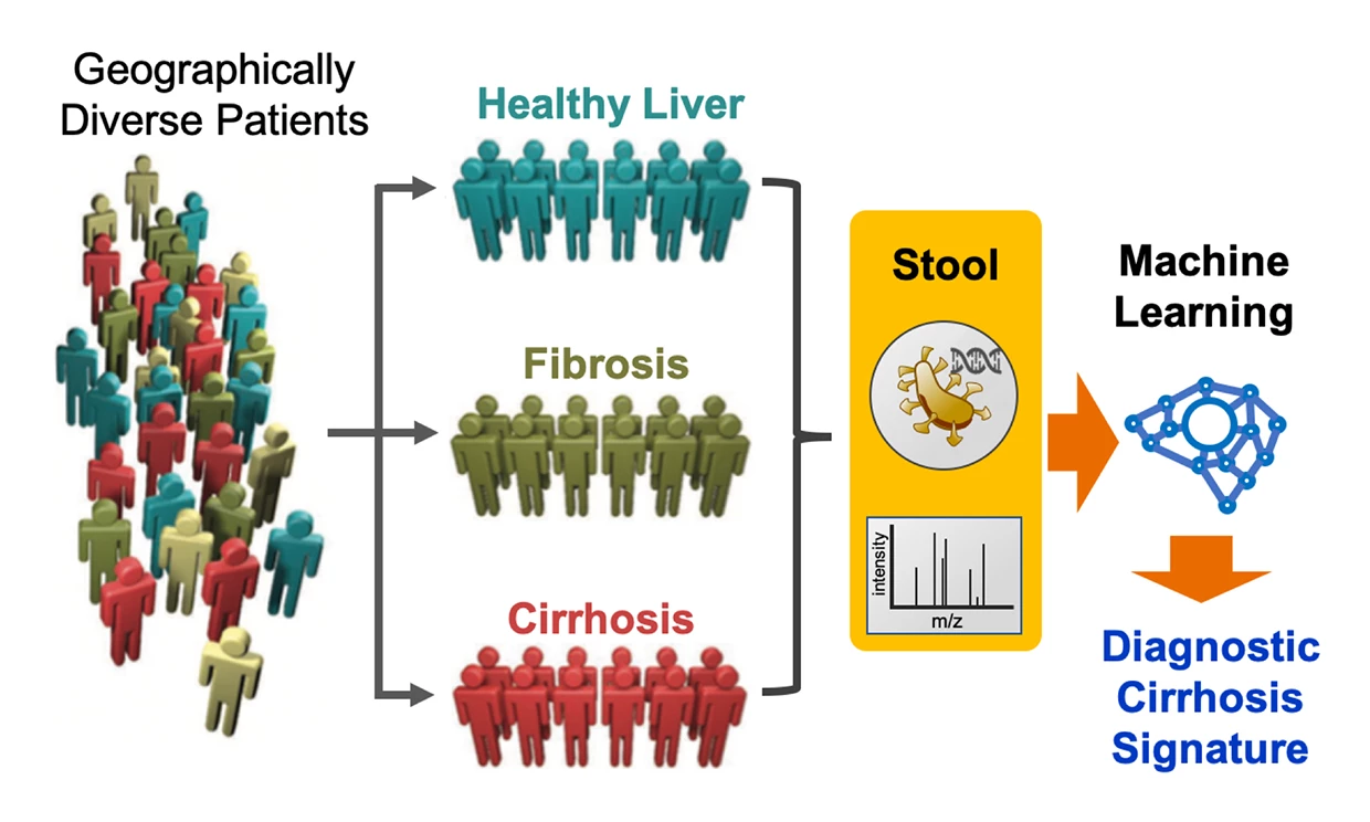 The researchers behind a new study have demonstrated how a machine learning algorithm can detect advanced liver disease, even among subjects from different populations