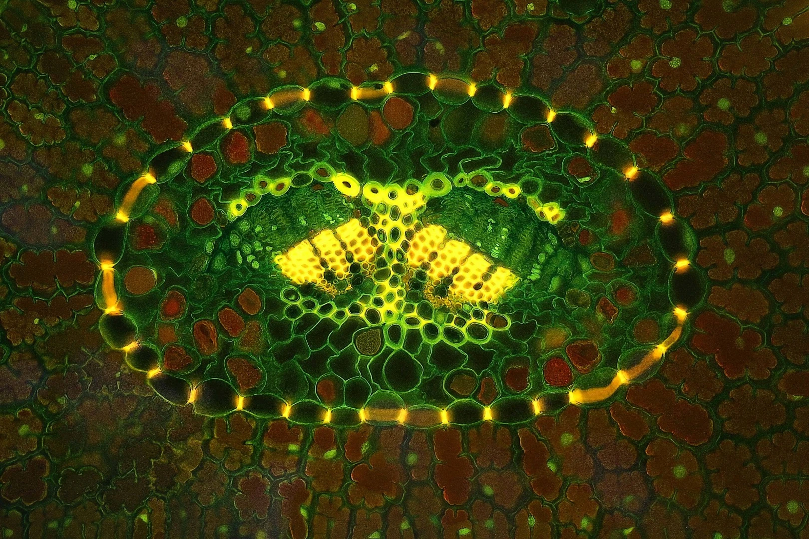 Image of Distinction: Vascular bundle of a Bosnian pine tree leaf