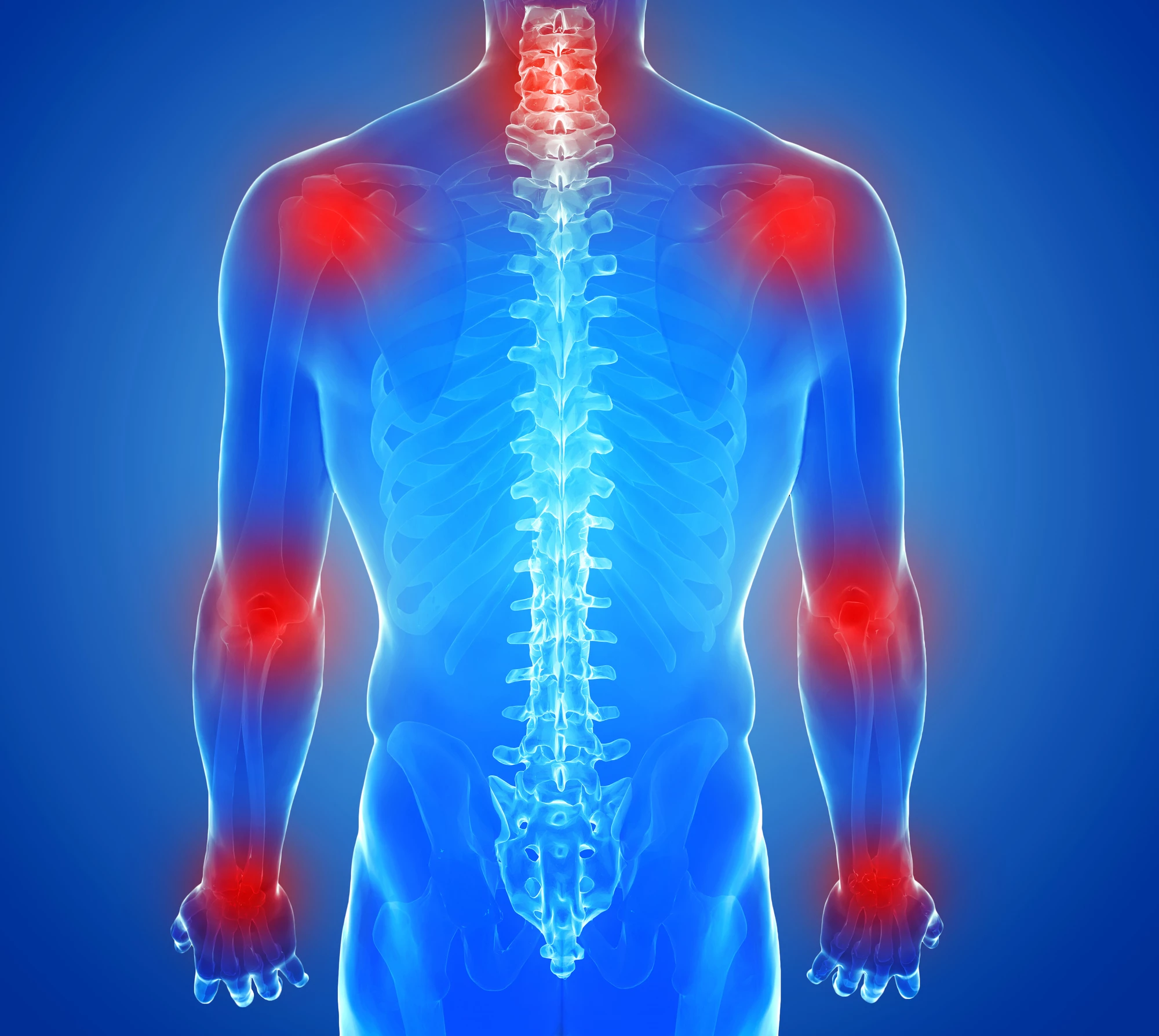 A new study has pinpointed a biological mechanism behind spreading inflammation in rheumatoid arthritis