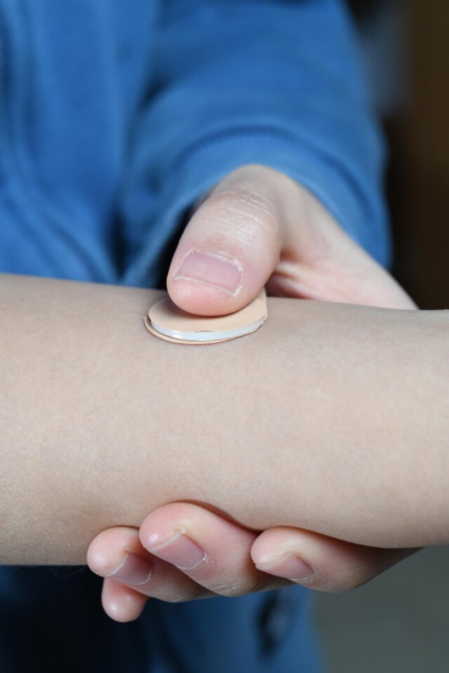 The painless patch contains microneedles loaded with drugs, which break off in the skin and slowly release levonorgestrel for over a month