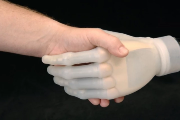 iLimb: fully articulating bionic hand