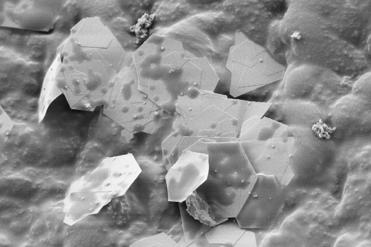 A microscope image of gold nanoplatelets embedded in a latex matrix