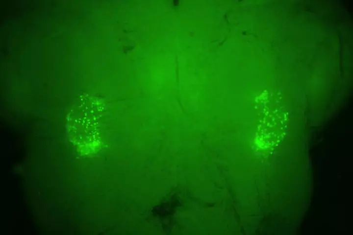 A fluorescent-green marker on each side of the brain stem illuminates the two networks of 200 neurons that control the sighing reflex