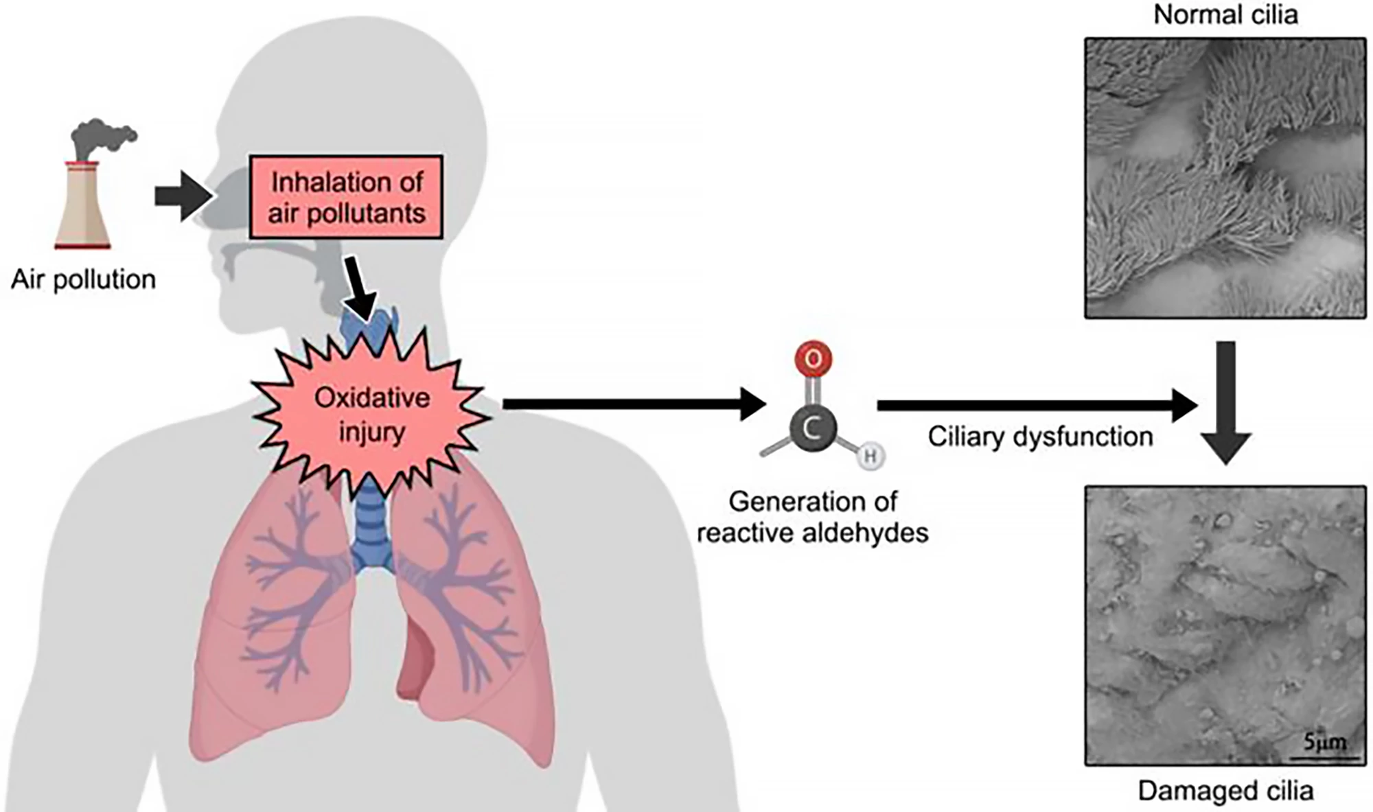 Exposure to PM2.5 leads to the production of reactive aldehydes that cause ciliary dysfunction