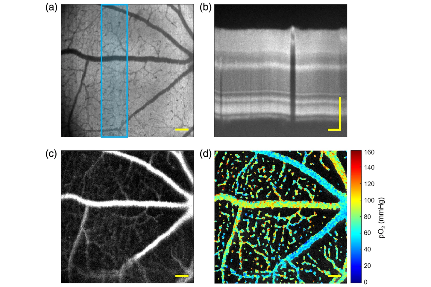 Simultaneous collection of images using VIS-OCT (top) and PLIM (bottom)