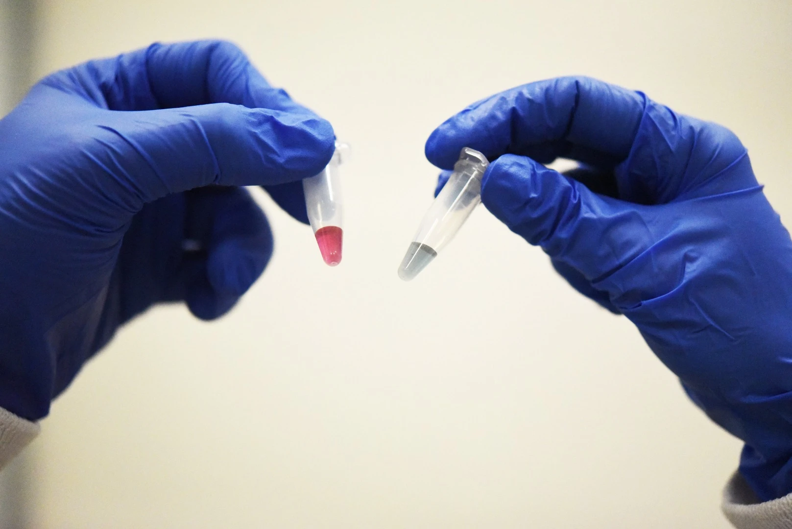 A new test using gold nanoparticles changes color if it detects the presence of cancer DNA