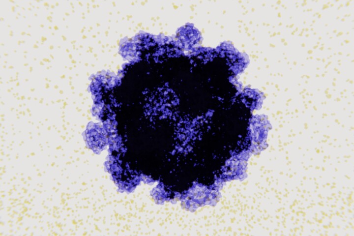 A study found norovirus, a common gastro infection, can trigger a process leading to Crohn's disease in people with certain genetic variants