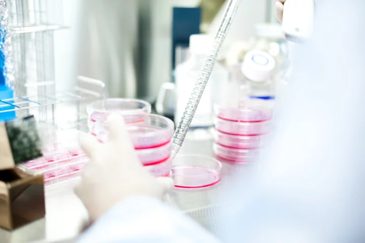 Scientists at Kyoto University are commencing trials on Parkinson's patients using induced pluripotent stem cells