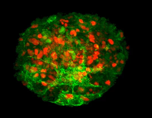 Spheres of cultured papillae cells from human hair follicles successfully produced new human hair when transplanted between the dermis and epidermis of human skin (Photo: Claire Higgins/Christiano Lab at Columbia University Medical Center)