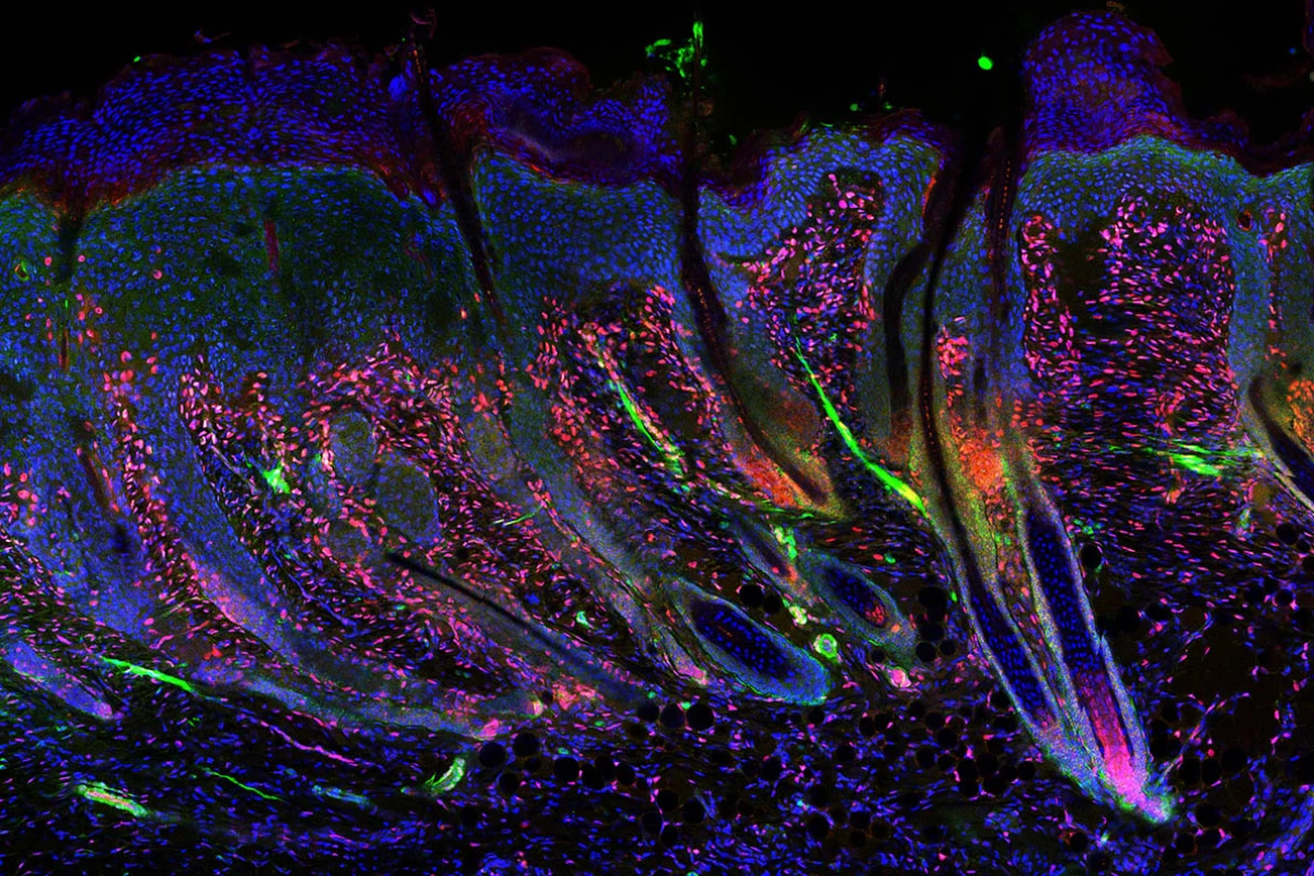 A microscope image of a regenerating skin wound with hair follicles that can make goose bumps – the green lines are the muscles attached to individual regenerating hairs, so that they can stand up