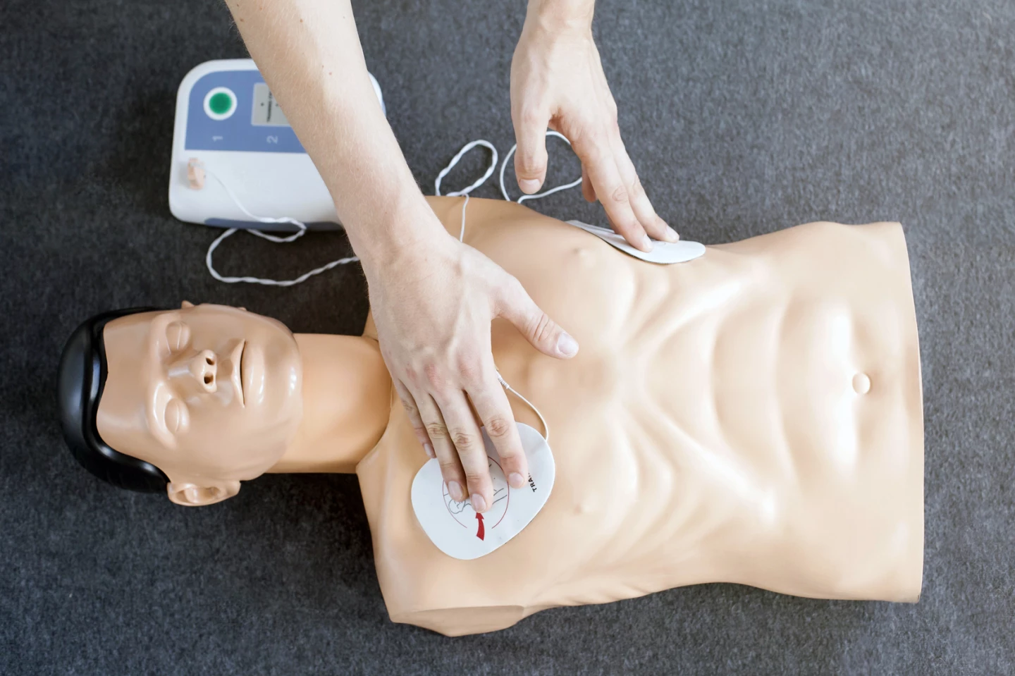 Usually, both defibrillator pads are placed on the left and right of the chest, in an anterior-lateral position