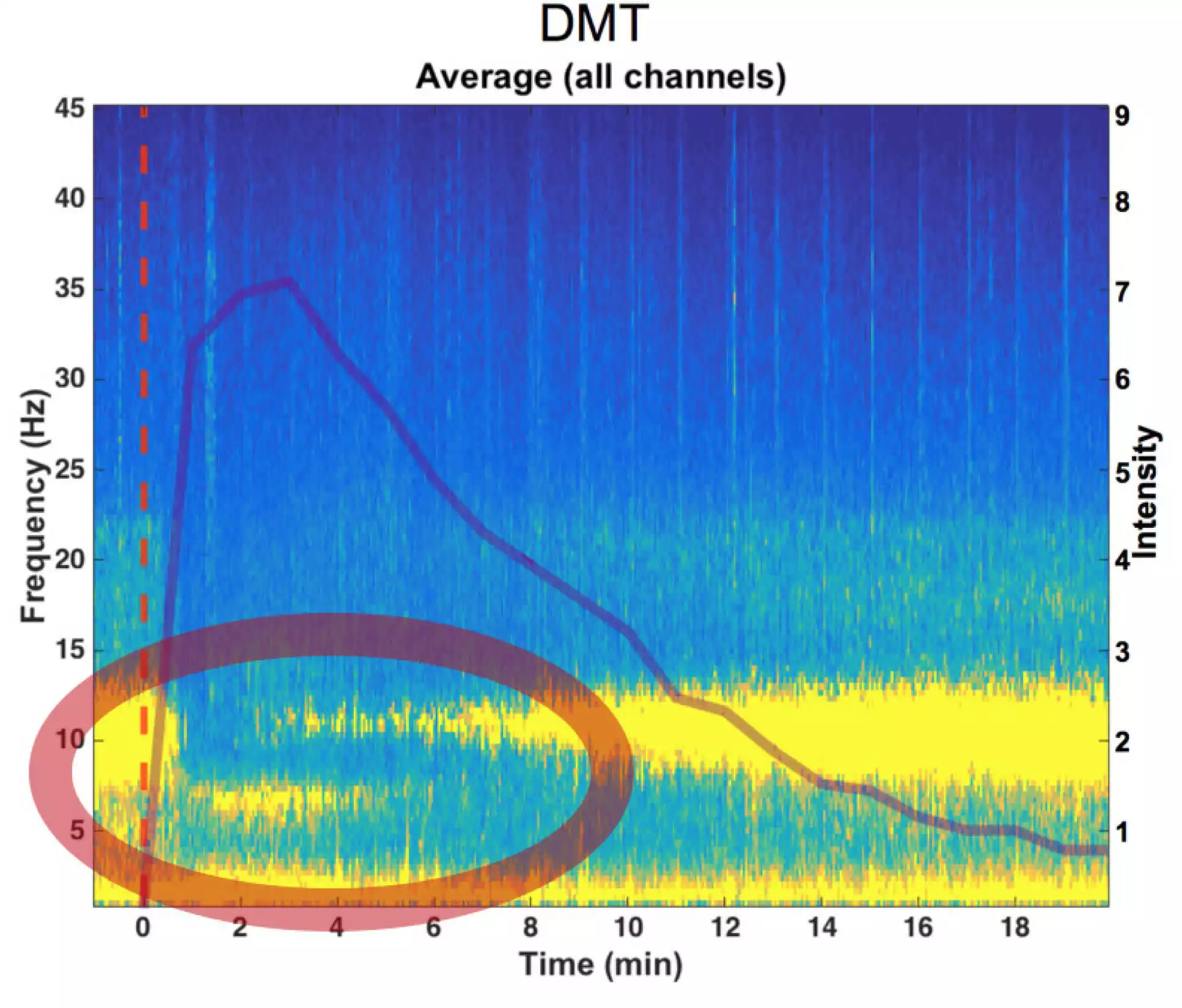 Graph of brainwave activity after subject is administered with DMT. The circled section is known as the "breakthrough" moment when the psychoactive effects rapidly kick in