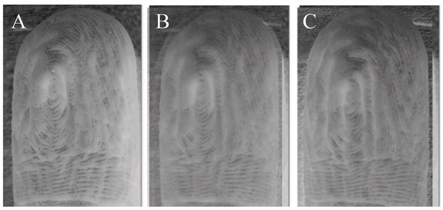 Because finger wrinkles after prolonged immersion are caused by blood vessels beneath the skin contracting, the patterns of wrinkles stay constant