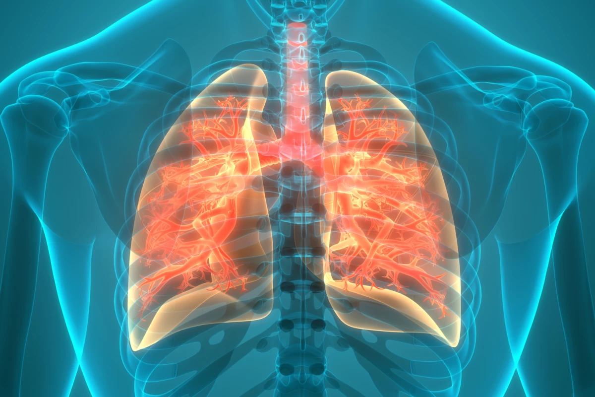 A new study is the first to investigate a link between the gut microbiome and chronic obstructive pulmonary disease (COPD)