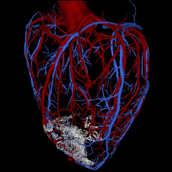 In the weeks following the injections, the cells infiltrated the damaged tissue, maturing to form new muscle fibers and beat in synchrony with the heart