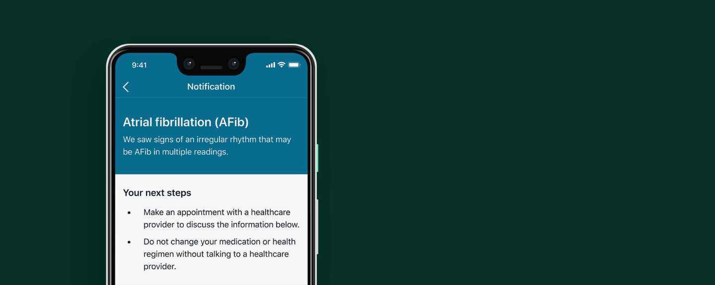 The feature continuously monitors a wearer's heart rate and sends a notification when signs of arterial fibrillation are detected