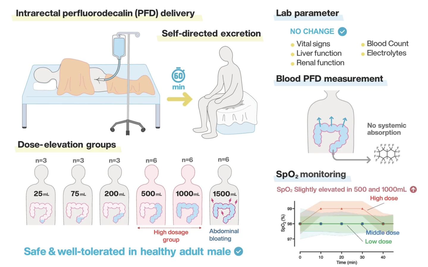 Visual abstract shows highlights of enteral ventilation concept developed by Takanori Takebe, MD, PhD, and colleagues