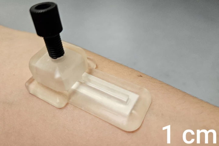 The prototype microneedle patch – the black screw on top maintains downward pressure to keep the needles in contact with the skin