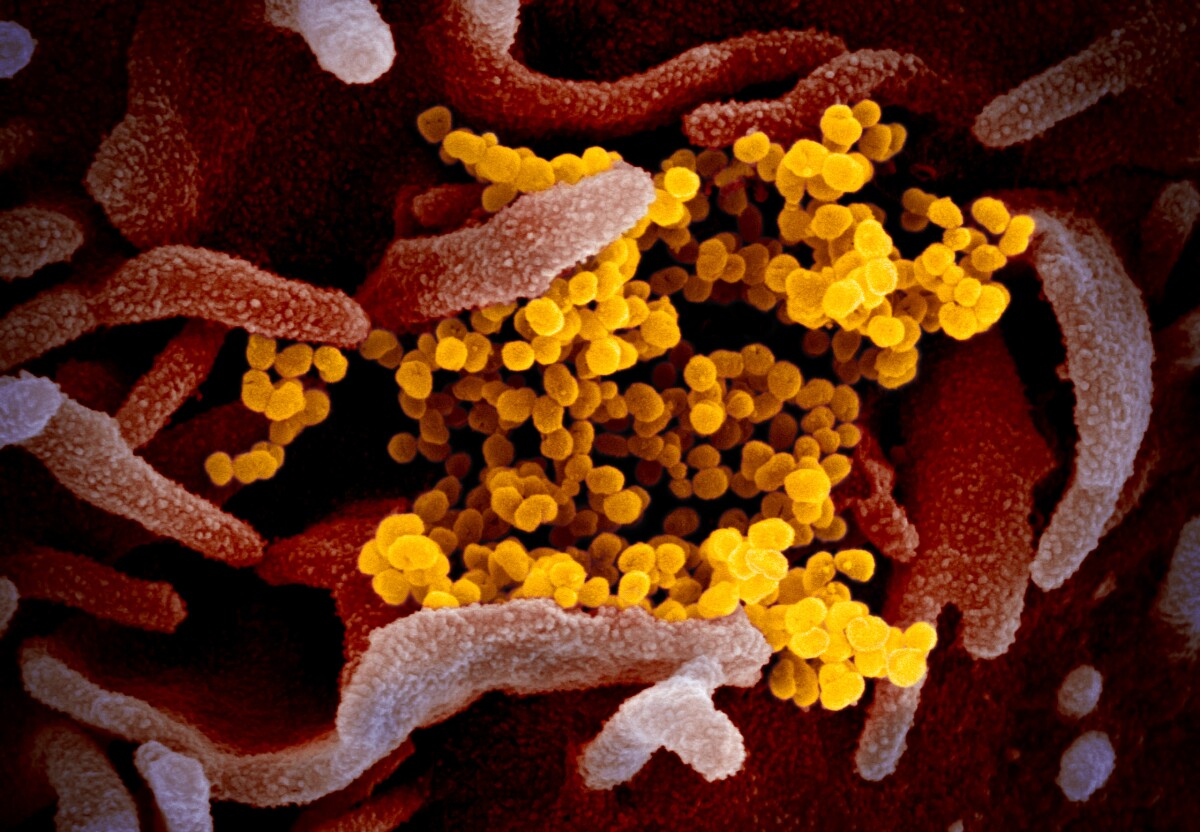 This scanning electron microscope image shows SARS-CoV-2 colored yellow, emerging from the surface of cells (colored pink)