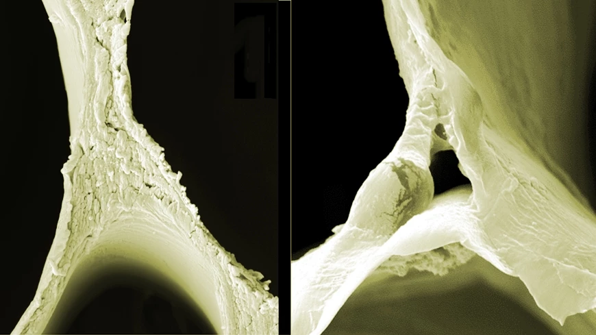 Scanning electron microscope images of regular balsa wood (left) and wood that's had its lignin removed (right), making it more compressible
