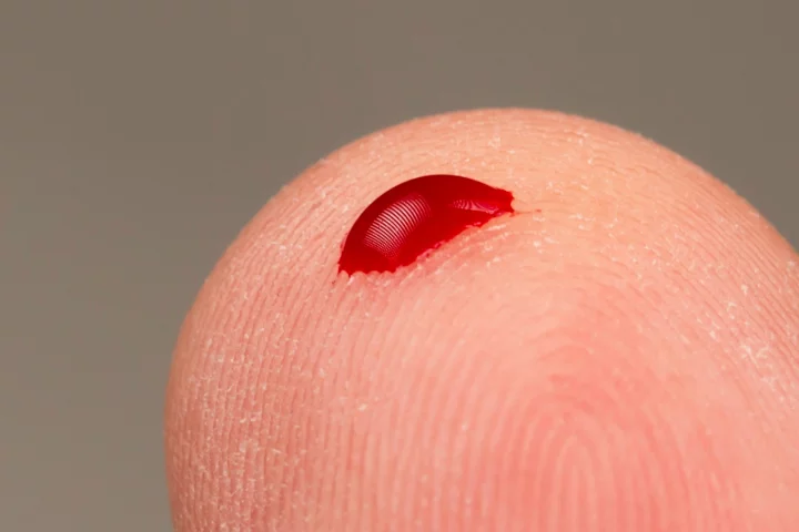Could breathalyzers replace lances in blood glucose tests?