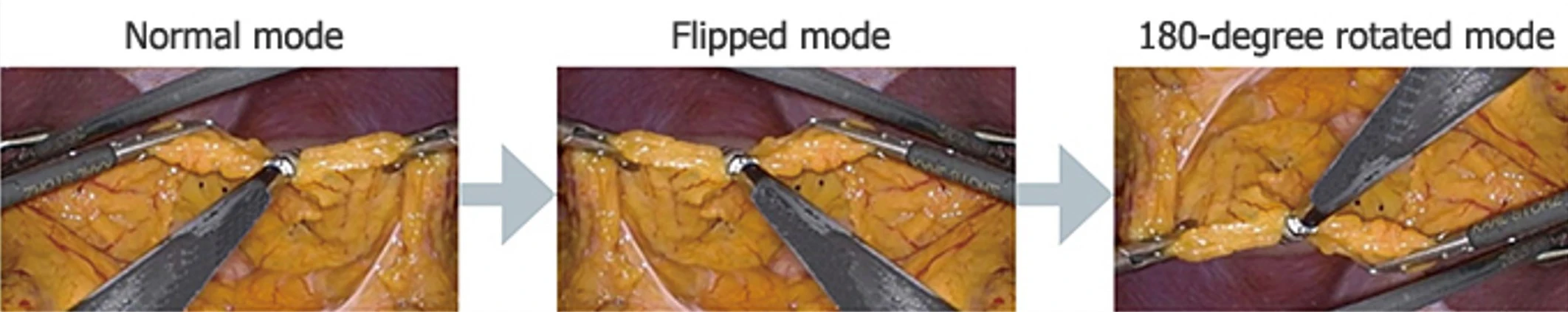 The image can be flipped to match the perspective of surgical team members